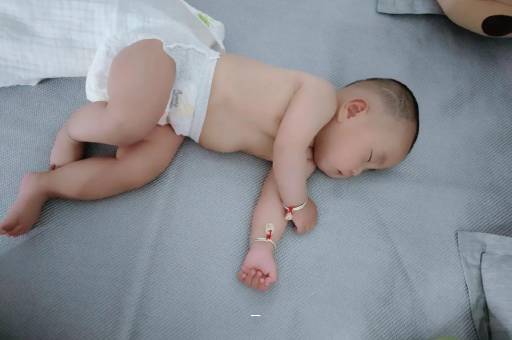 长春宝宝脸上有白色斑块